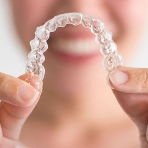 Clear Aligner Processing Service